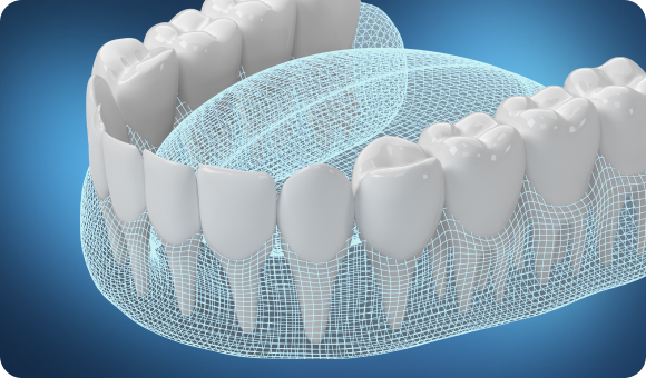 3Shape Dental System全新虚拟预处理技术