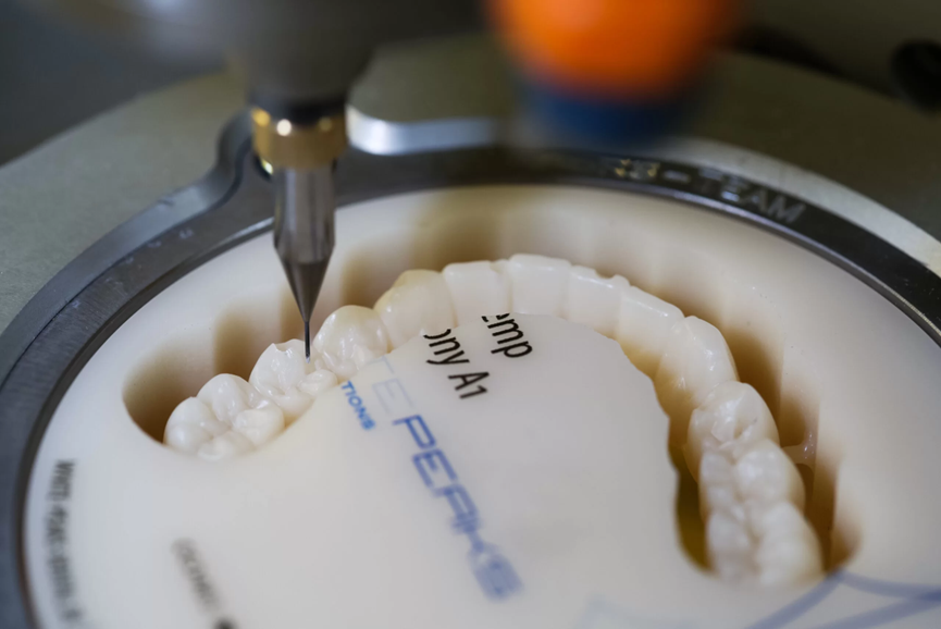 如何通过hyperDENT实现个性化修复体设计