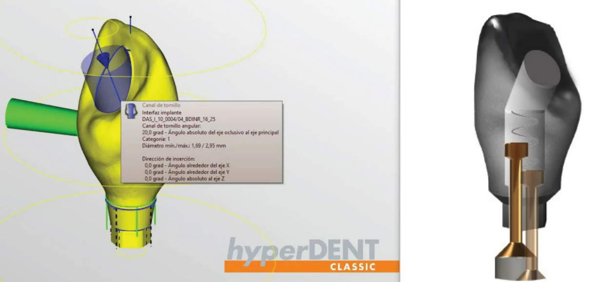 HyperDENT支持哪些导出格式